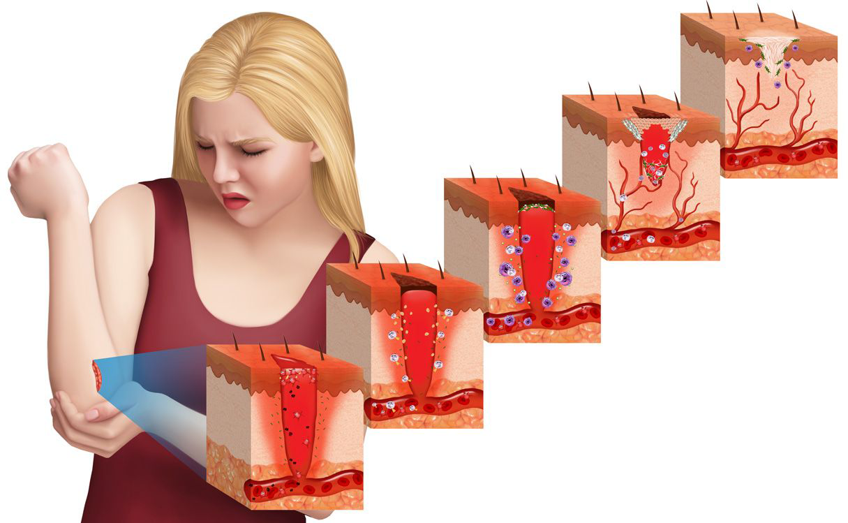 قوی ترین کرم ترمیم کننده پوست (کرم آلوئه ورا ژلی)